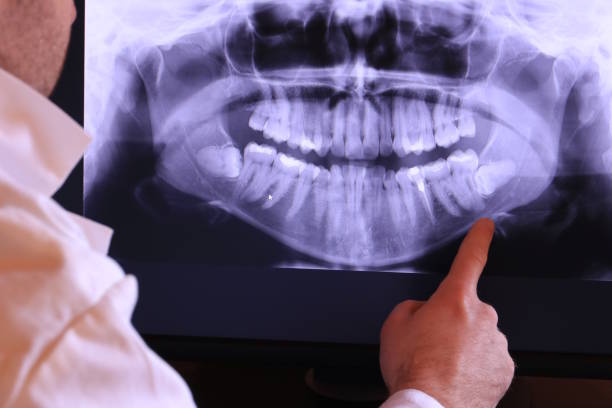Best Emergency Tooth Extraction in North Scituate, MA