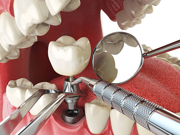 Best Walk-In Emergency Dentist in North Scituate, MA